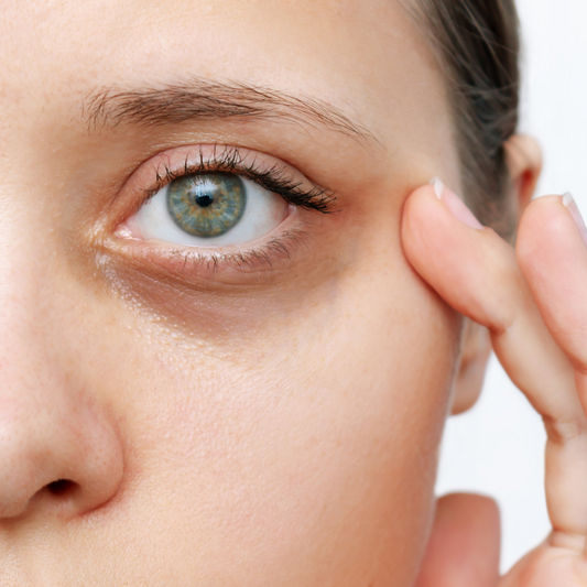 Tired/Dull Skin